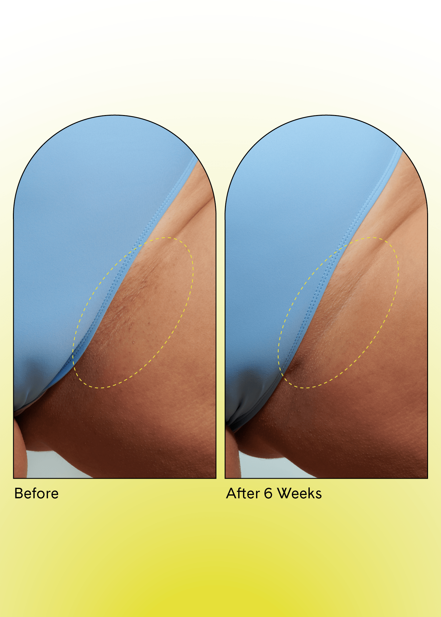 Fur Ingrown Concentrate trial results, soothes irritation and softens skin