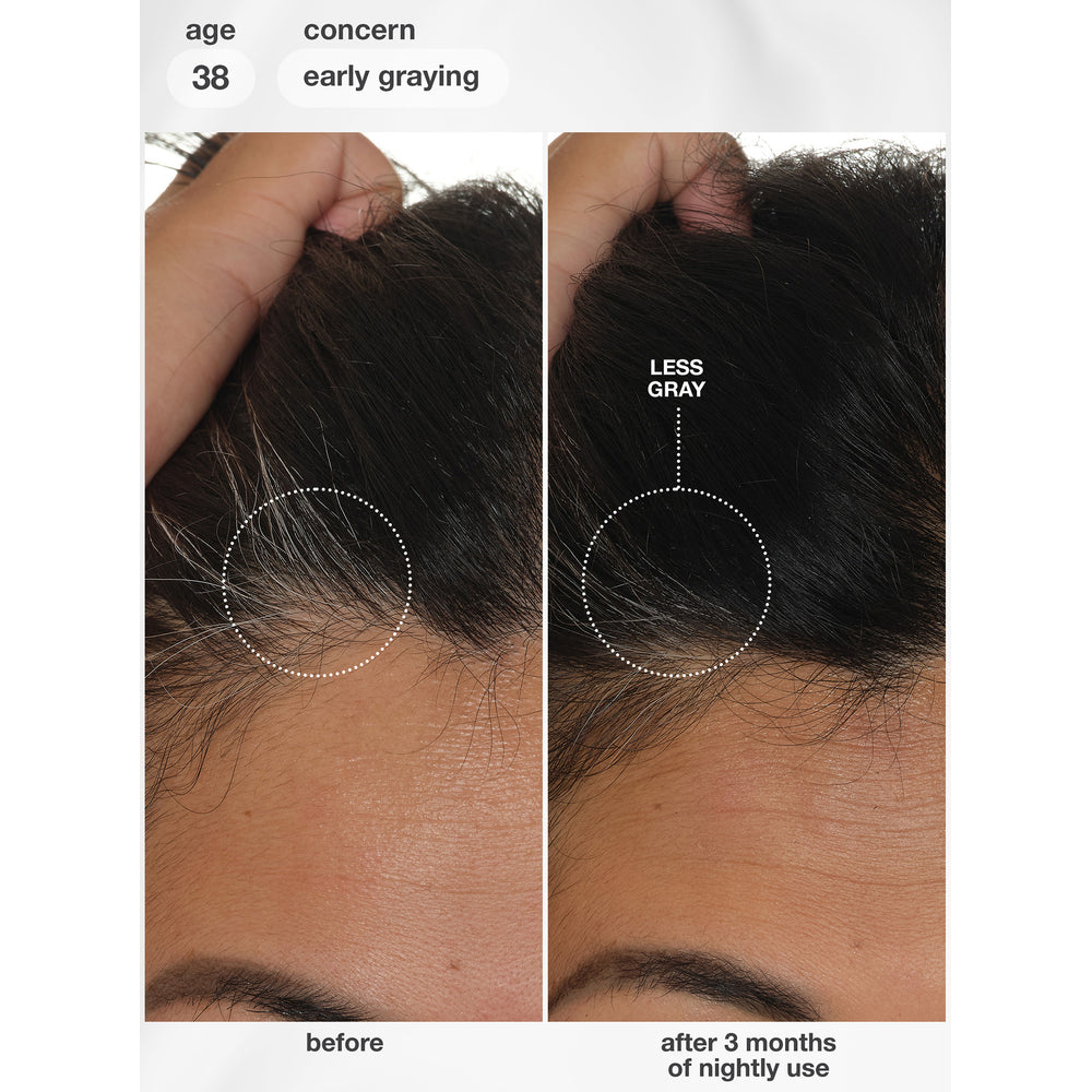 K18 FutureIQ Hair Longevity Serum before and after 3 months of nightly use for early greying, age 38