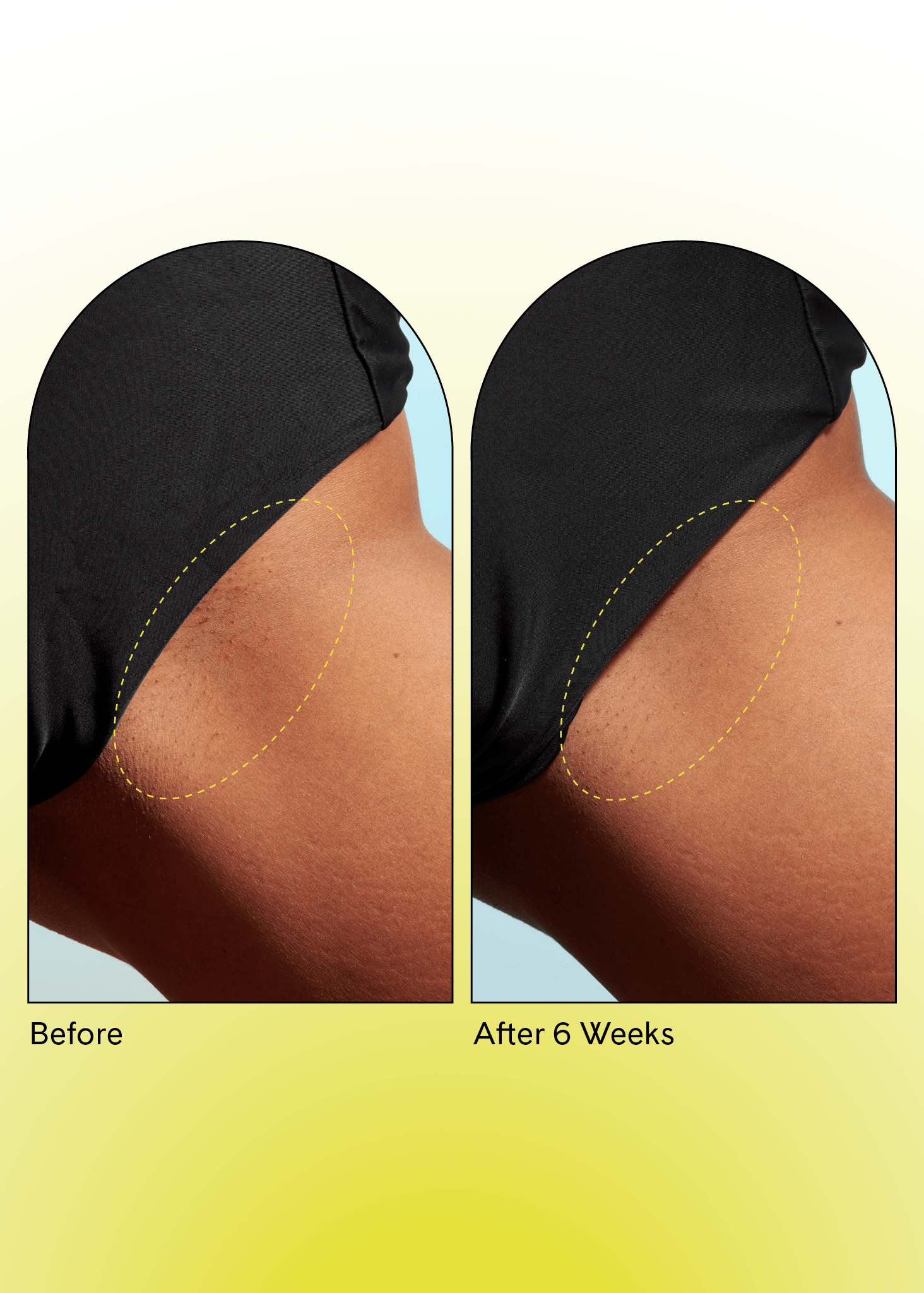 Fur Ingrown Eliminator Serum trial results, brighter, toned skin