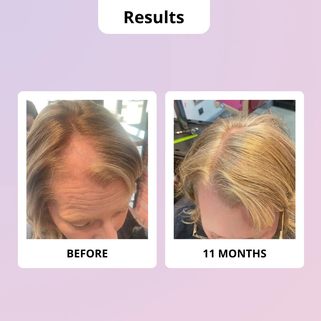 Before and after comparison of hair growth using GLOWWA on a light purple background.