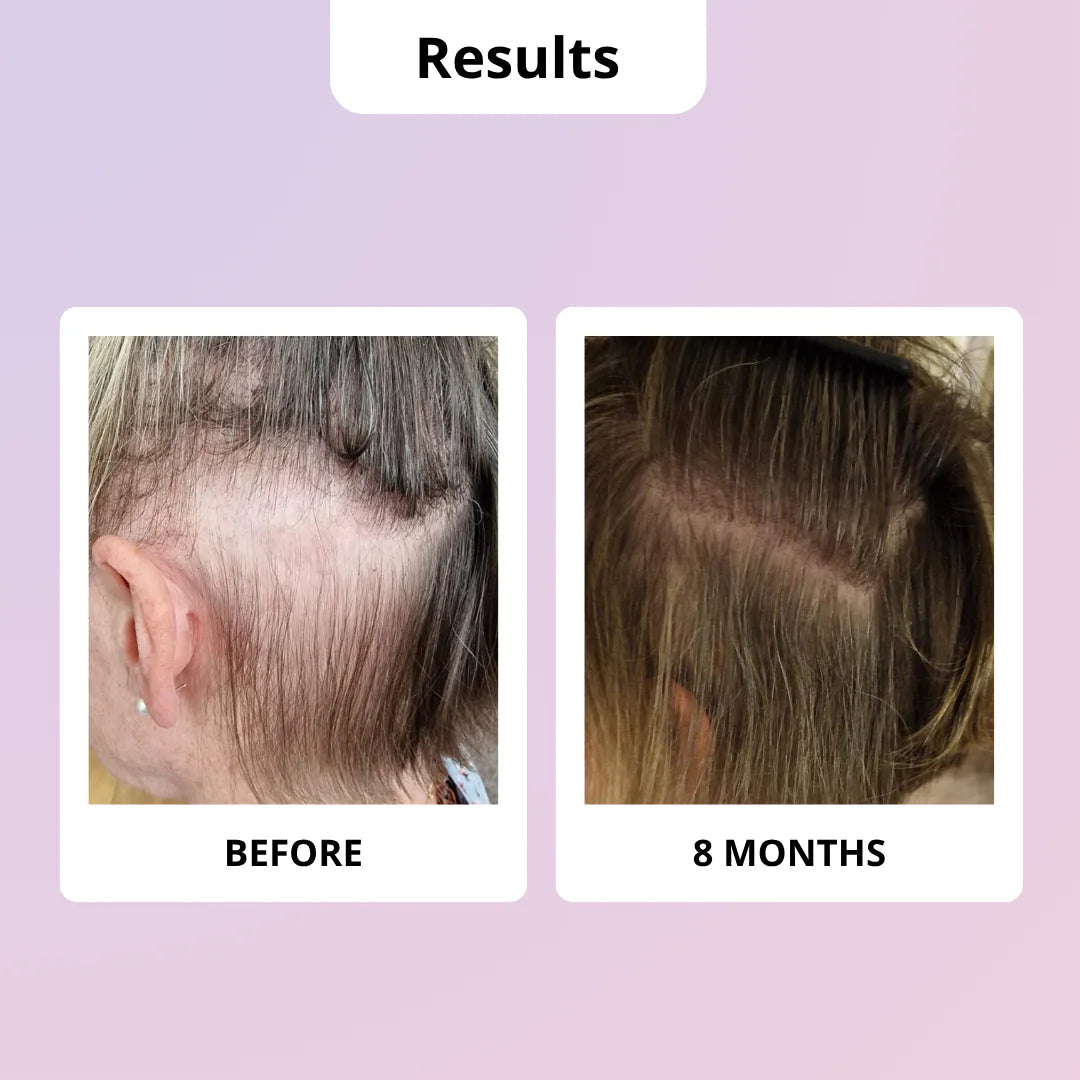 Before and after hair growth results using GLOWWA on a light purple background
